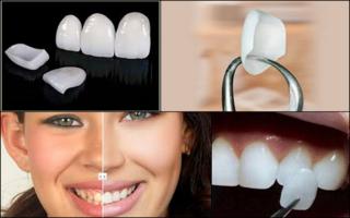 GOE - Implantes Dentrios e Prteses  no Santo Agostinho - BH