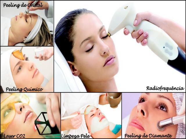 Radiofrequencia Peelig Facial na Savassi