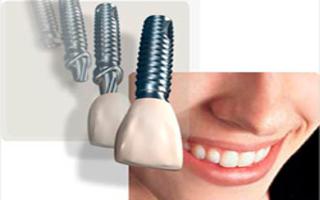 GOE - Implantes Dentrios e Prteses  no Santo Agostinho - BH