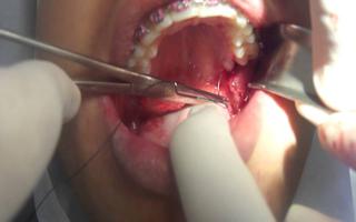 GOE - Cirurgio Dentista na Savassi
